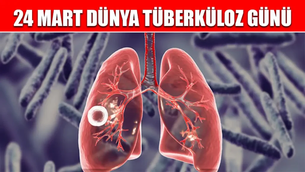 Sağlık Bakanlığı’ndan Dünya Tüberküloz Günü açıklaması – BRTK
