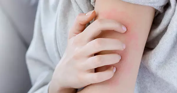 Gerekli tedbirler alındı – BRTK