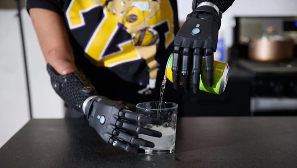 Mucize biyonik el: Koldan ayrıldığında bile hareket ediyor – Son Dakika Teknoloji Haberleri