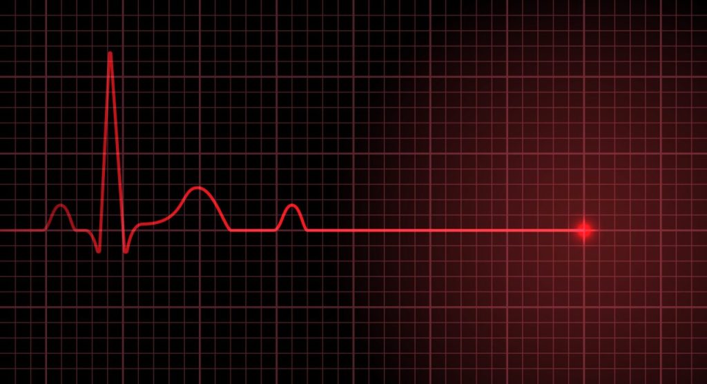 Selçuk Nadıç’ın ölüm sebebi “masif pulmoner emboli” – BRTK