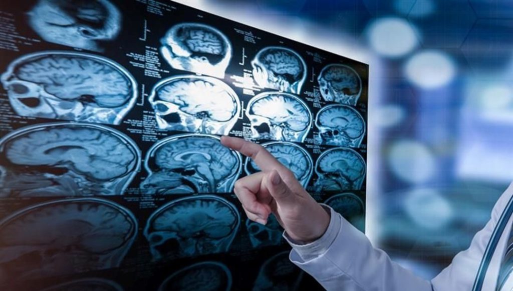 Hafızamız sabit değilmiş: Beyin, aynı anıyı her seferinde farklı kaydediyor – Son Dakika Teknoloji Haberleri