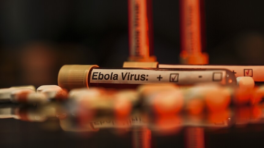 ABD’de 2026 FIFA Dünya Kupası öncesi bazı havalimanlarında Ebola tarama merkezleri kurulacak – BRTK